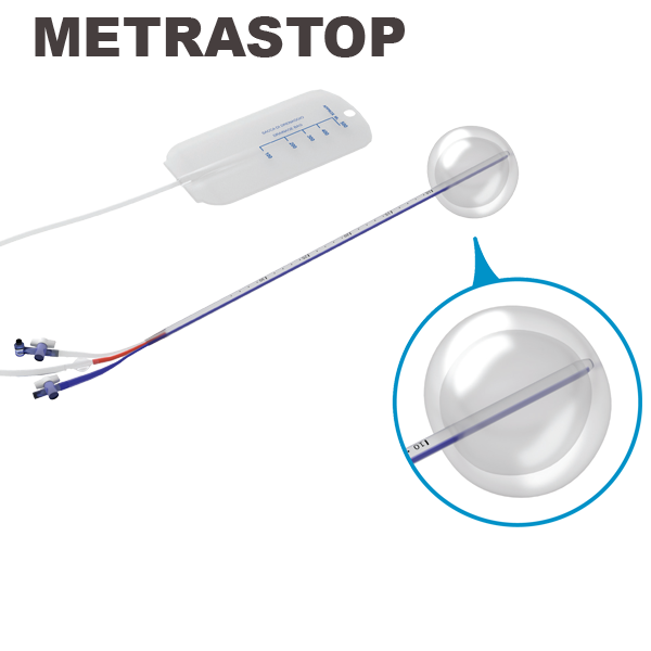 Tamponada balonowa - rodzaje